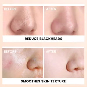 Private Label No Logo Gentle Exfoliating Gel, Deep Cleansing Dead Skin Remover Hydrating Facial Skin Care
