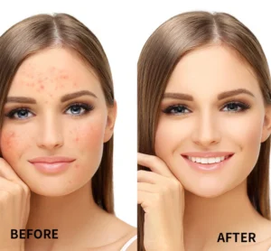 Private Label No Logo Waterproof Concealer Cream, Blemish Dark Circle Covering Contour Brightening Long Wear Facial Makeup