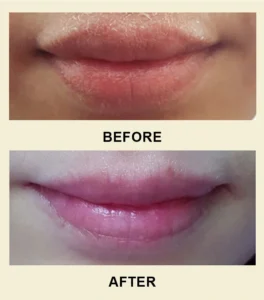 Private Label No Logo Lip Scrub Exfoliating Gel, Dead Skin Remover Softening Nourishing Lip Care Product