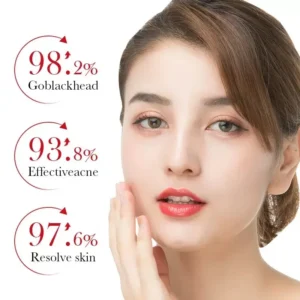 30ml Private Label No Logo Red Version Salicylic Acid Acne Repair Facial Serum, Oil Control Blackhead Minimizing Pore Clearing Essence for Problem Skin